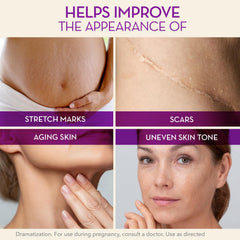 Cicatricure Cica Oil for Stretch Marks & Scars, 6.7 oz